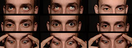Eight-and-a-Half Syndrome