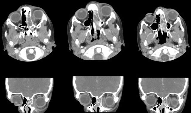 CT scans pre-treatment