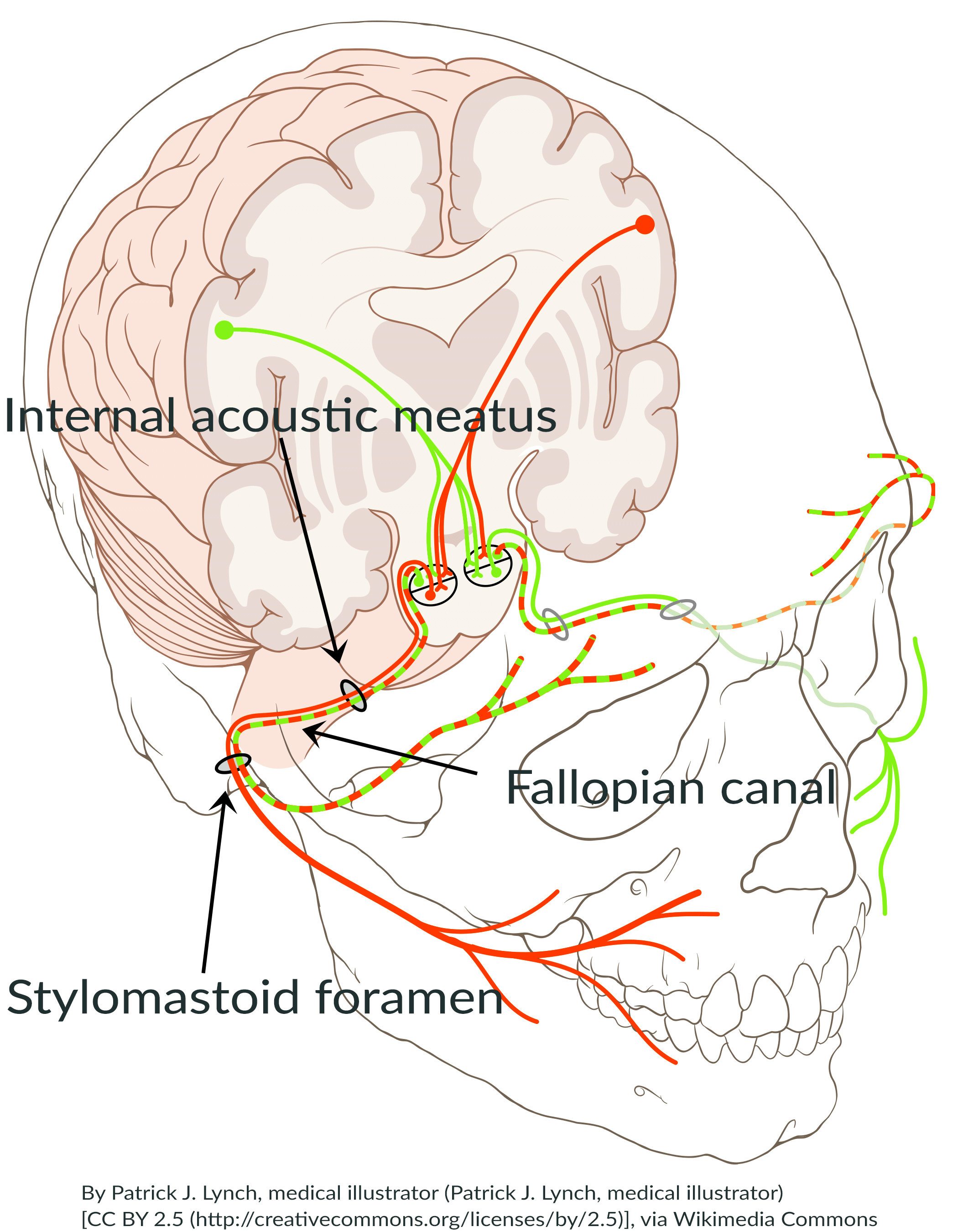 Facial Nerve Decompression 51