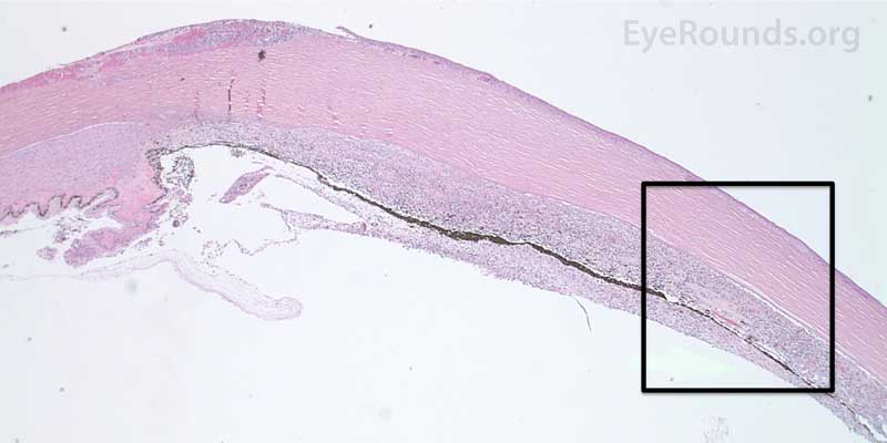 The upper hematoxylin and eosin (H&E) image (10X) shows the location (black box) of the lower image (40X).