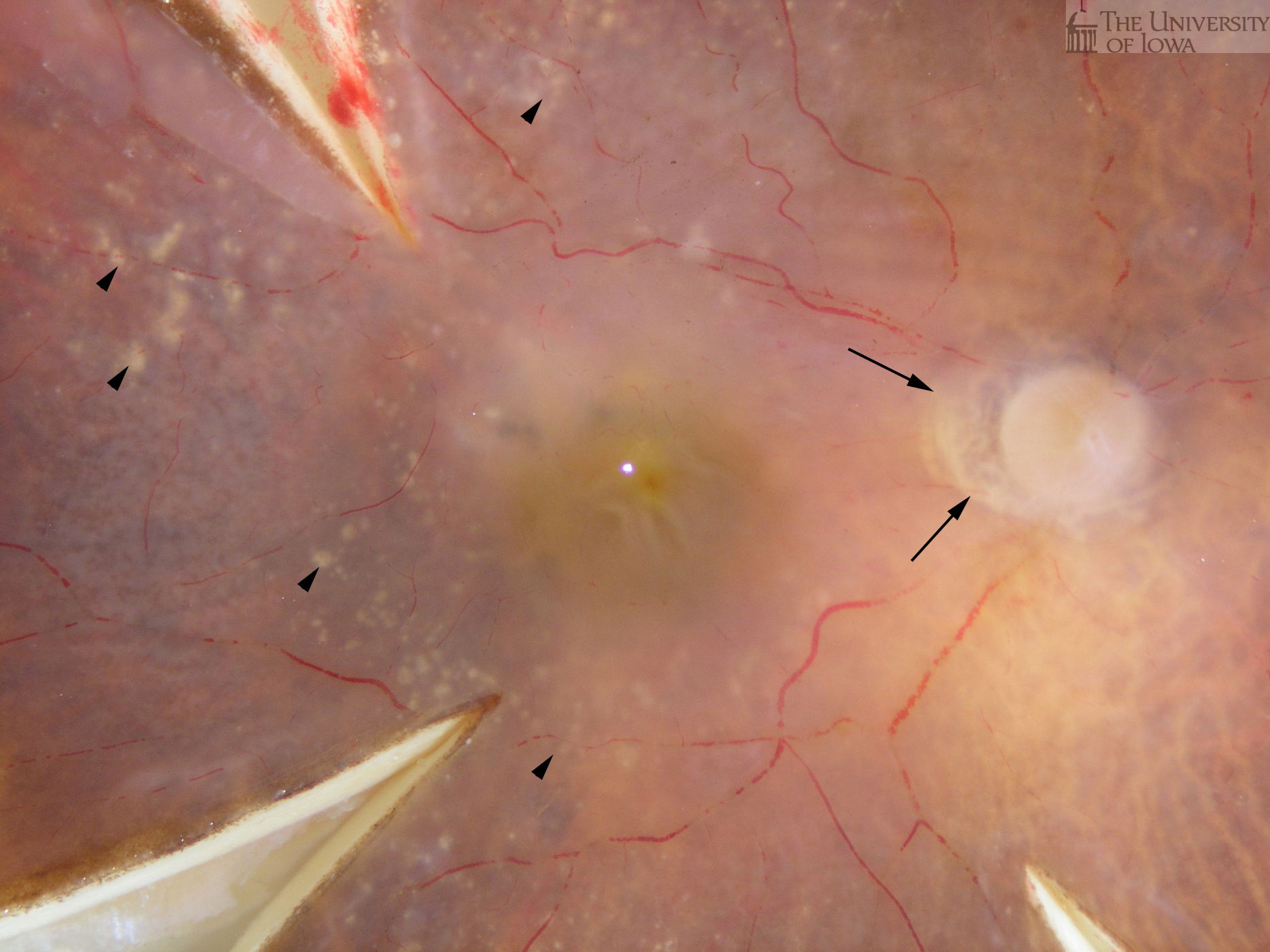 donor fundus image 