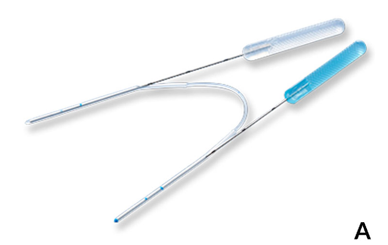 (A) Kaneka Lacriflow stent with attached bougies, (B) Schematic of the stent demonstrating variable diameter and openings in the system [10] 