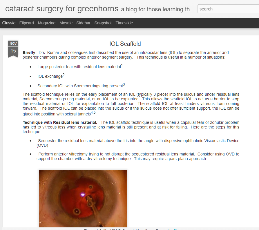 cover of cataract surgery for greenhorns