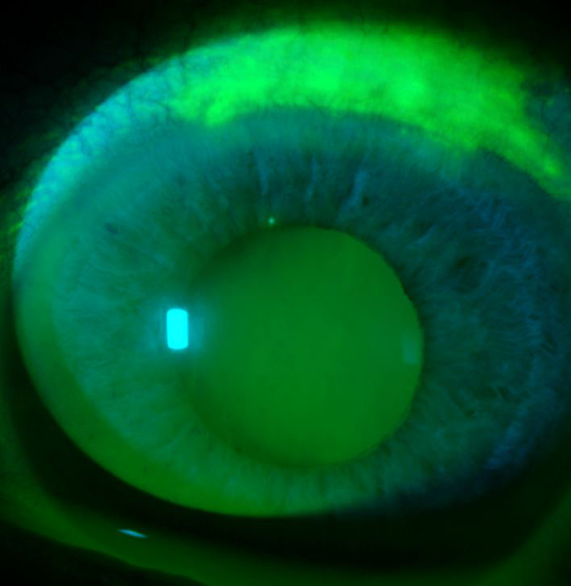 Cornea Header