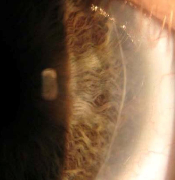 Cornea Header