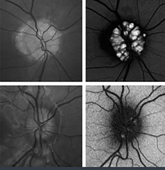 Neuro-Ophthalmology Header