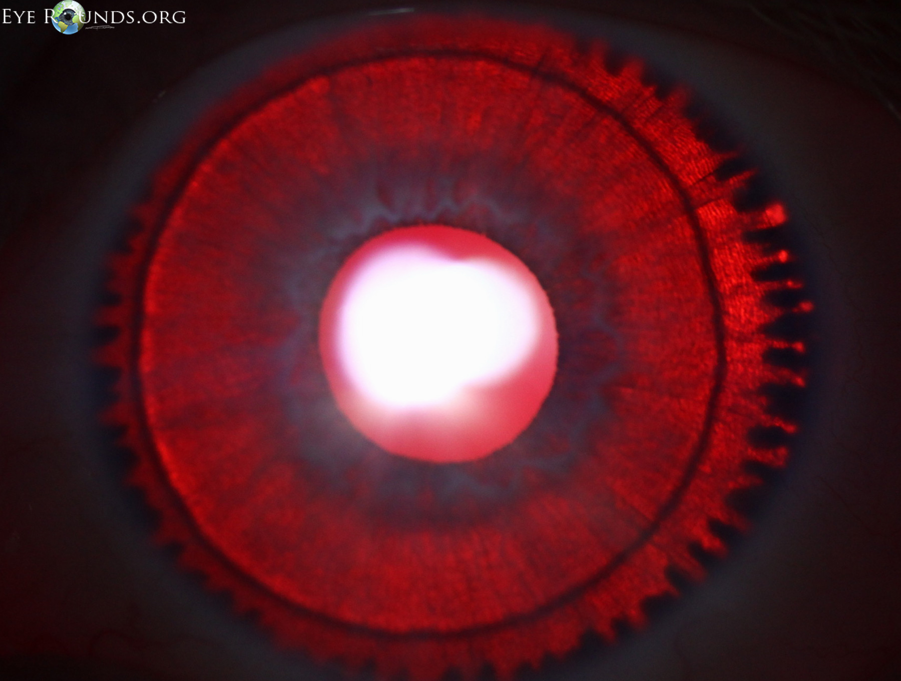 photo of ref illumainted eye