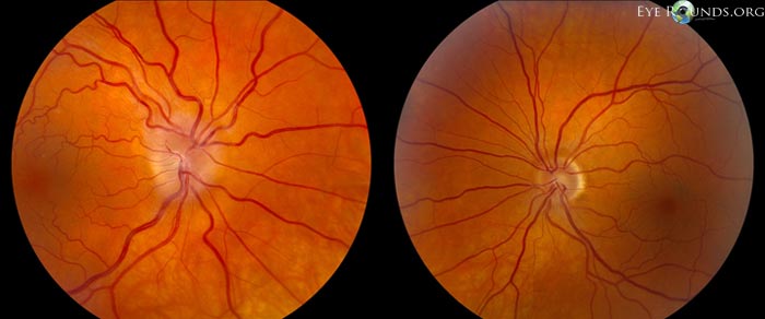 fundus images