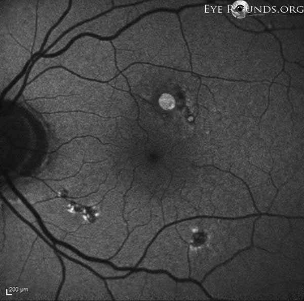 Autofluorescence imaging