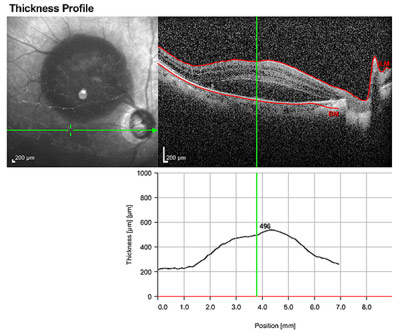 Figure 2A