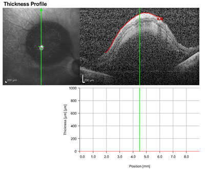 Figure 2B