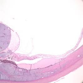 histopathology