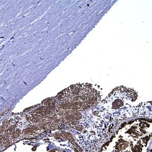 histopathology