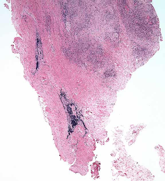 Hematoxylin and eosin stain. 20X 