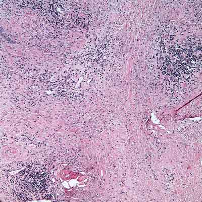 Hematoxylin and eosin stain. 50X