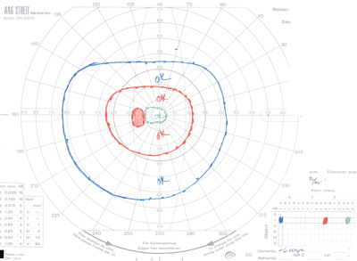 Figure 2A