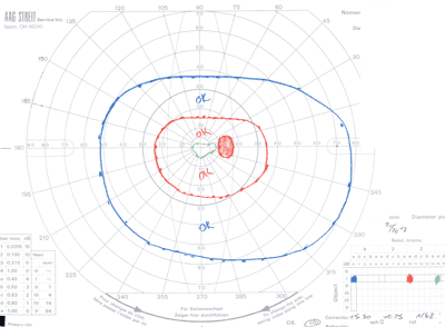 Figure 2B