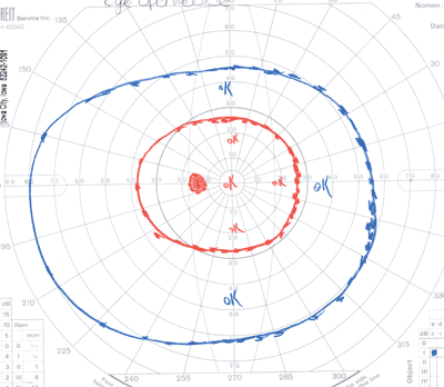 Figure 4A