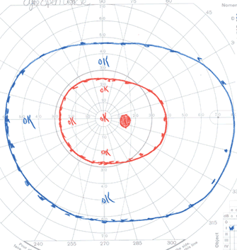 Figure 4B