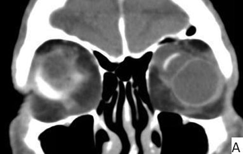 coronal view