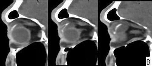 sagittal view