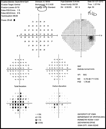 Figure 2b