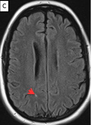 Figure 3c