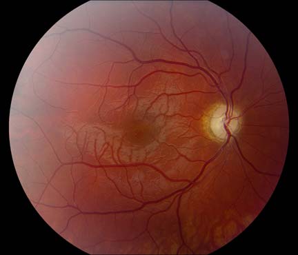 Fundus