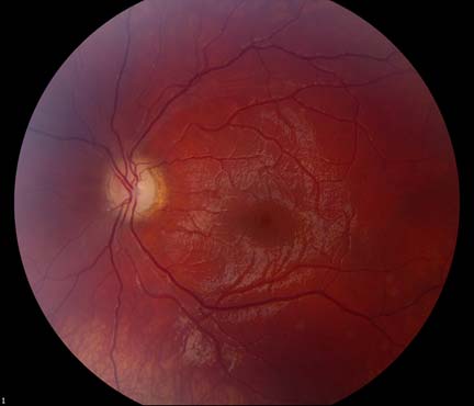 Fundus