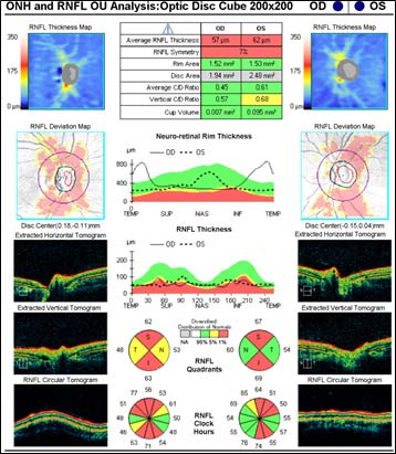 Fundus