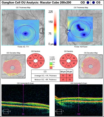 Fundus