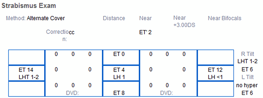 Strabismus Exam
