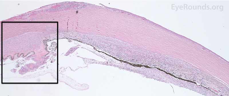 The upper H&E image (10X) shows the location (black box) of the lower image (40X). 