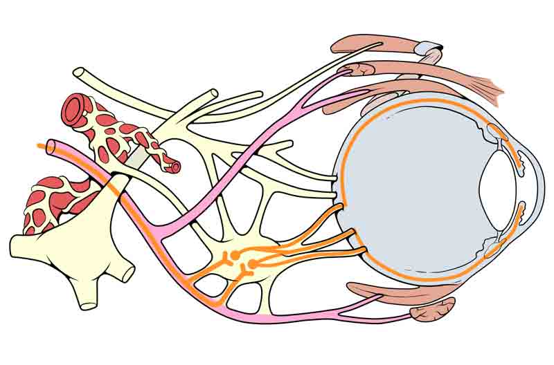 Anatomic diagram demonstrating the close proximity of the parasympathetic nerve fibers with the oculomotor nerve. Note that the ciliary ganglion is where the parasympathetic synapse occurs, and the postganglionic nerve fibers travel to innervate the sphincter muscle of the pupil, allowing for pupillary constriction. 