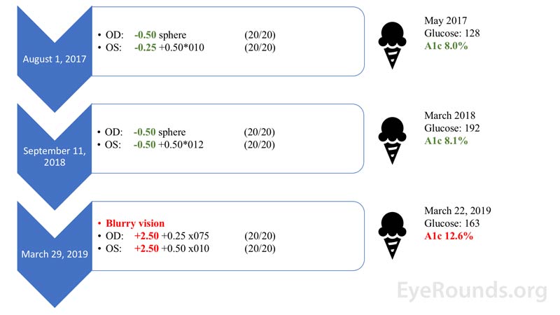 Refractive state relative to hemoglobin A1c before implementation of long-acting insulin