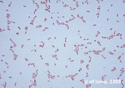 Gram Stain