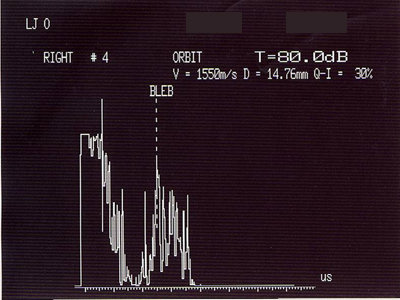 A-Scan Echo