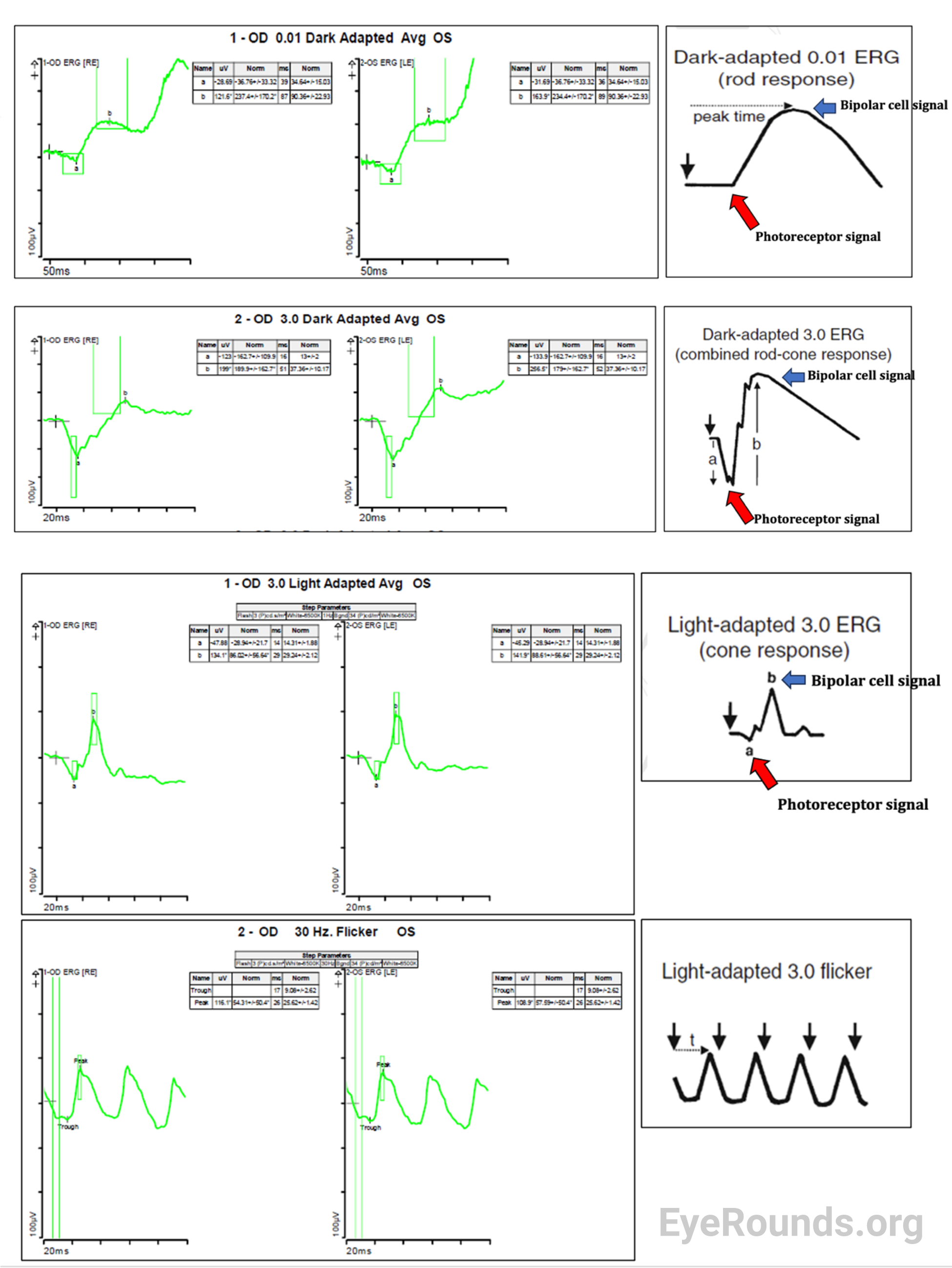 Dark adapted vs. light adapted ERG