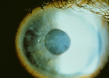 Fig 1 A clinical appearance