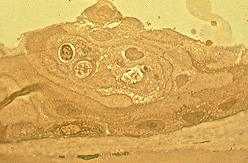 Histopathology, figure 1B