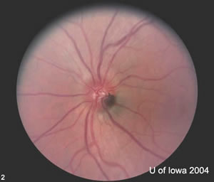 Fundus OS