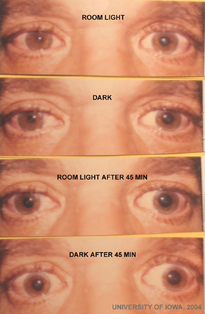 hydroxyamphetamine test