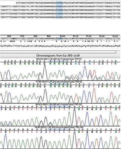 Figire 6. ABI bidirectional sequencing chromatogram