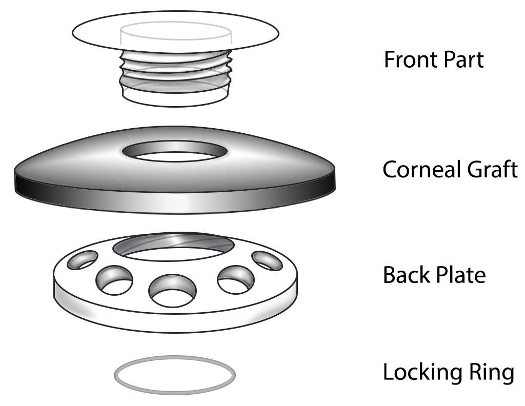 Assembly of the Boston Type I KPro device