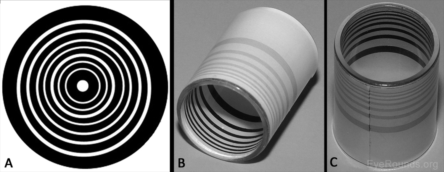 Qualitative corneal topography tools 