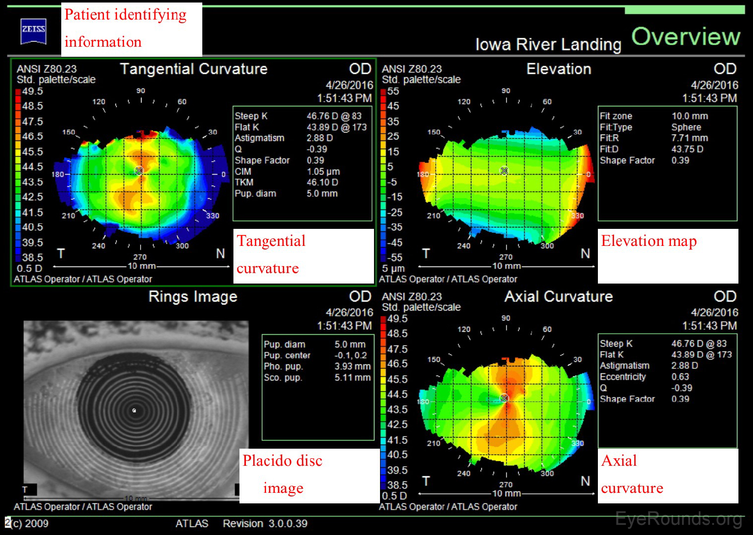 Zeiss Atlas Report 