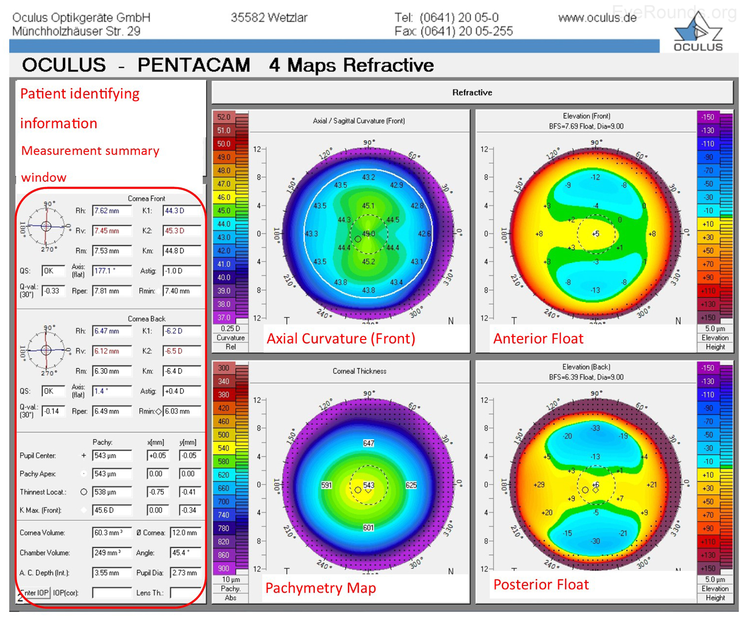 Pentacam 4 Map Report