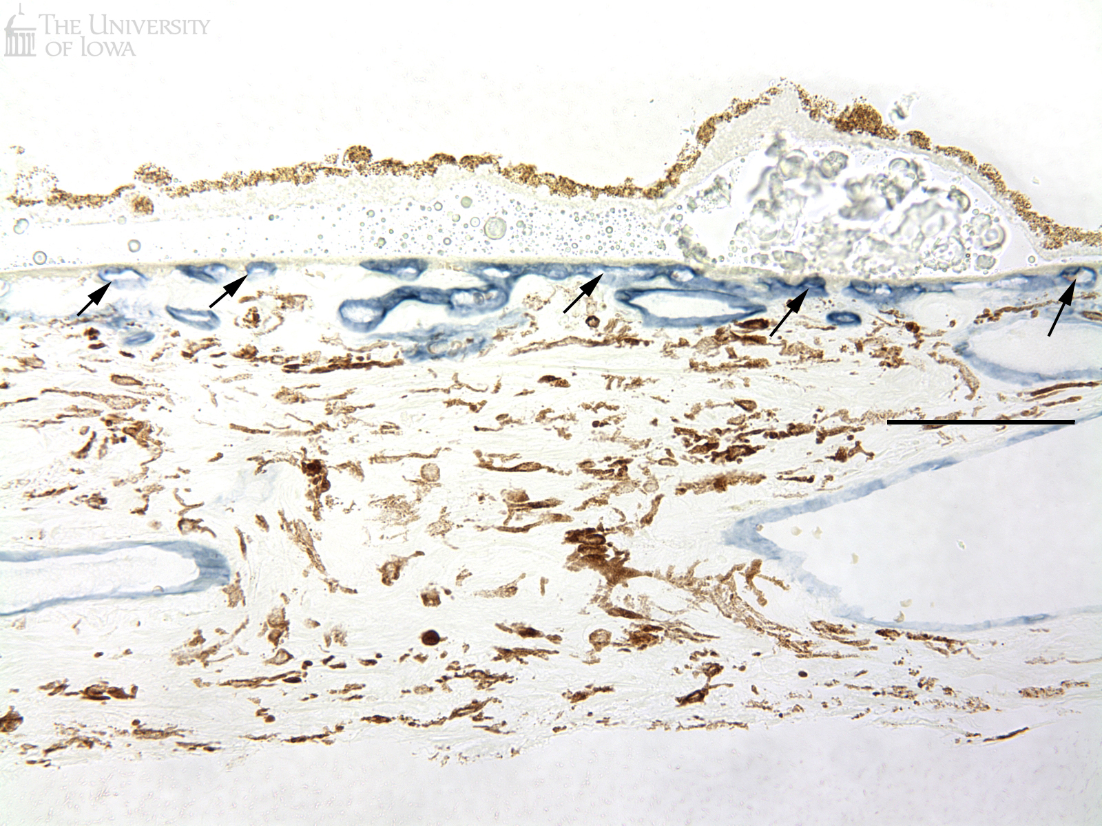 vasculature beneath choroid