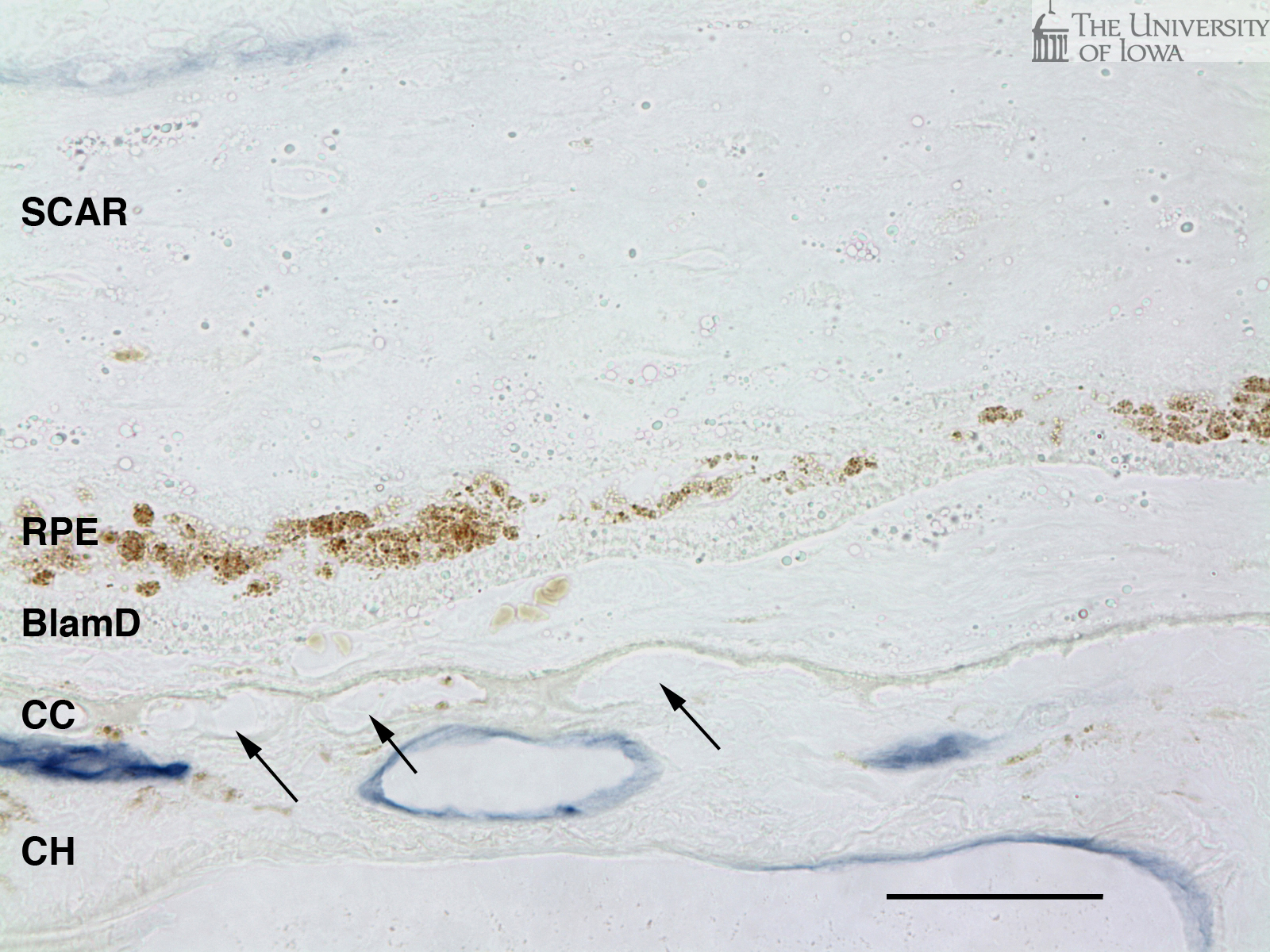 Choriocapillaris