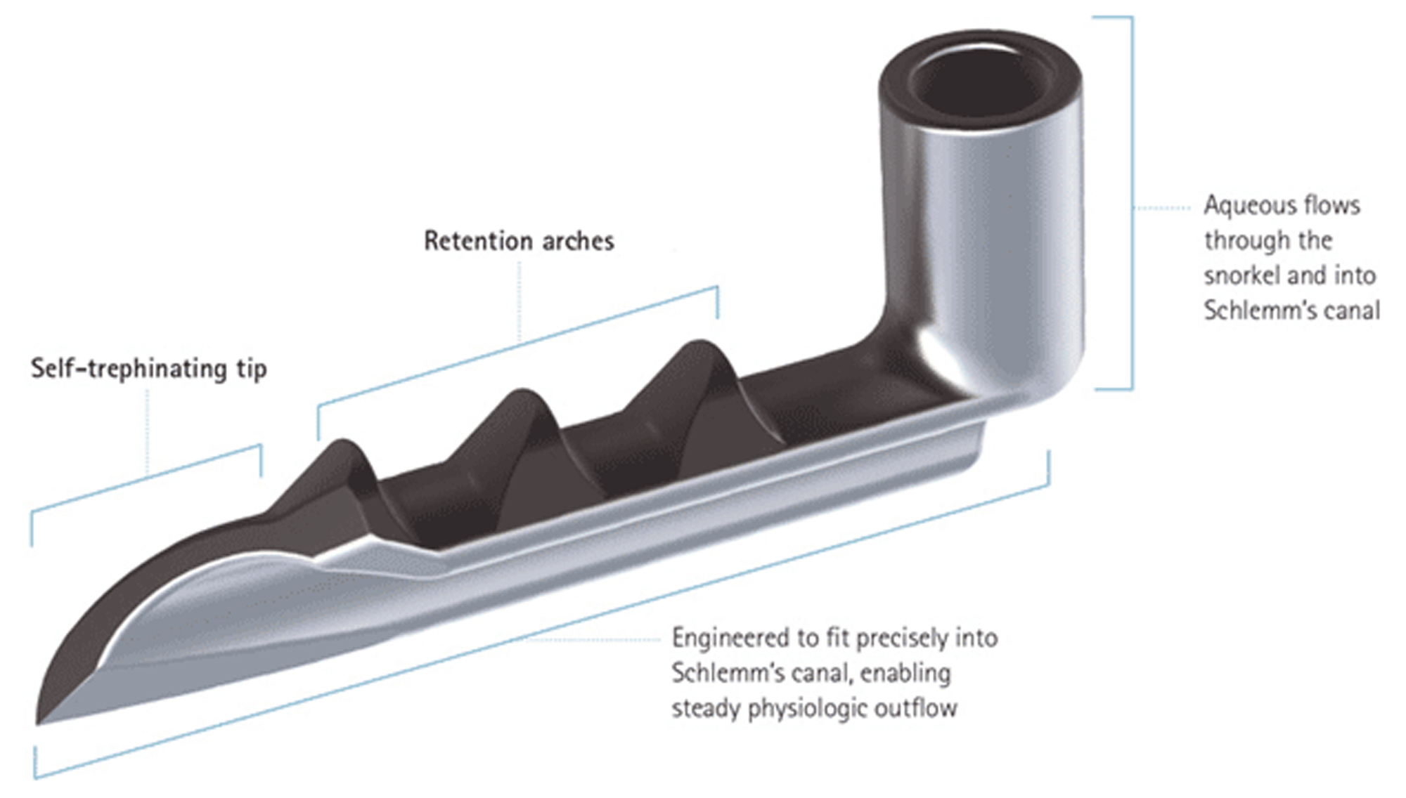 iStent Trabecular Micro-Bypass Stent. Source: Glaukos Corporation, http://www.glaukos.com/healthcare-professionals/istent/ Image used with permission. 